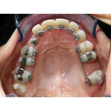 Cabinet De Tournemire orthodontiste Bezons