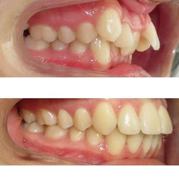 Traitement ortho chirurgical à Bezons